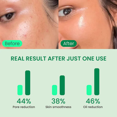 No More Pore Pads